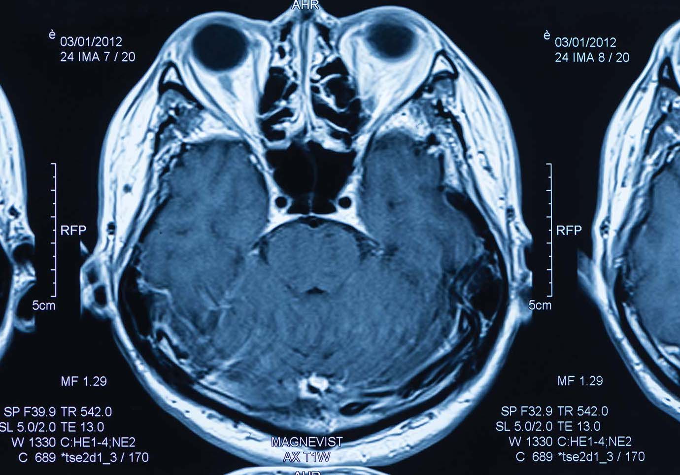 Roll Out the RADIOLOGISTS