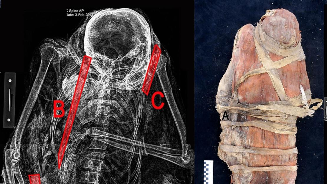 The mummy Salima Ikram is investigating